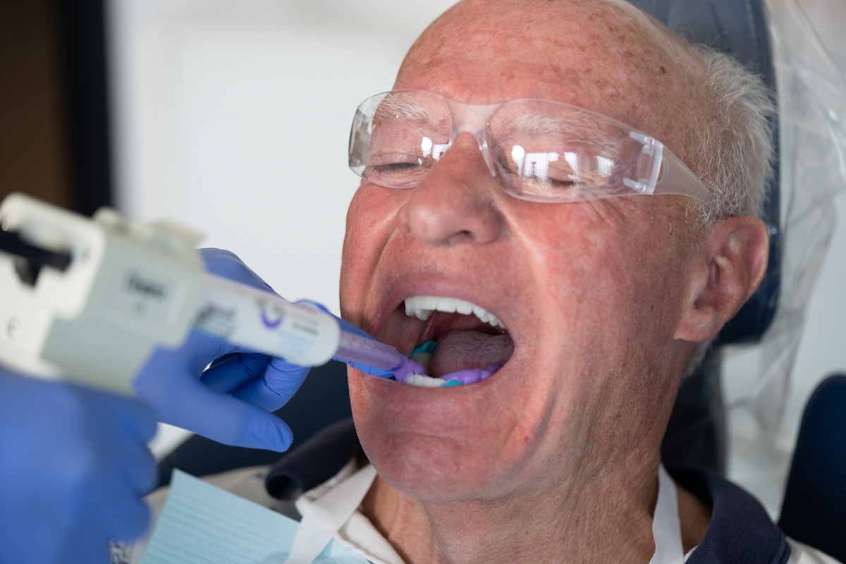 New bite registration 1  | Lucitone Digital Print Denture System