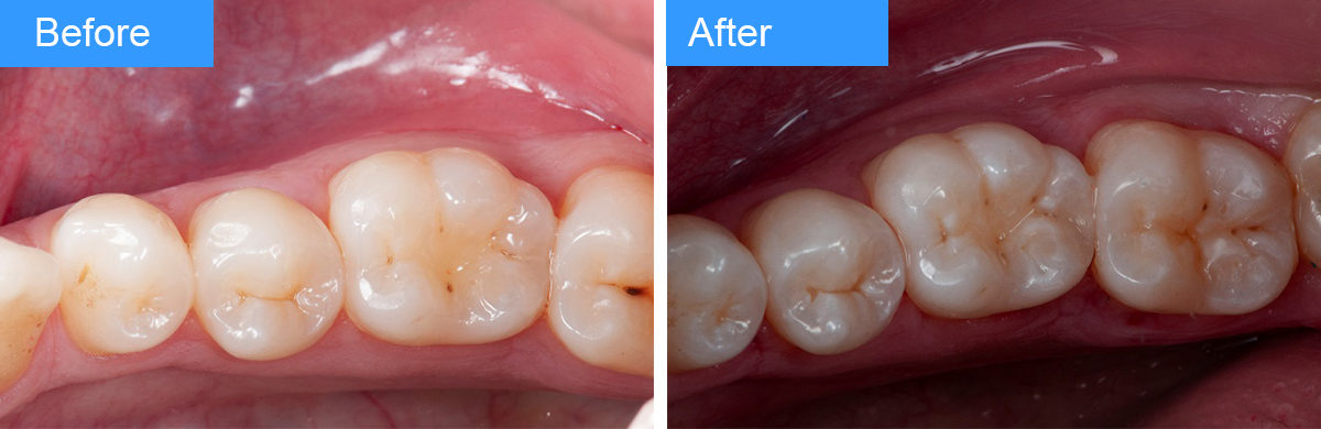 RES-Image-Pavolucci-Case-2-Before-After.jpg