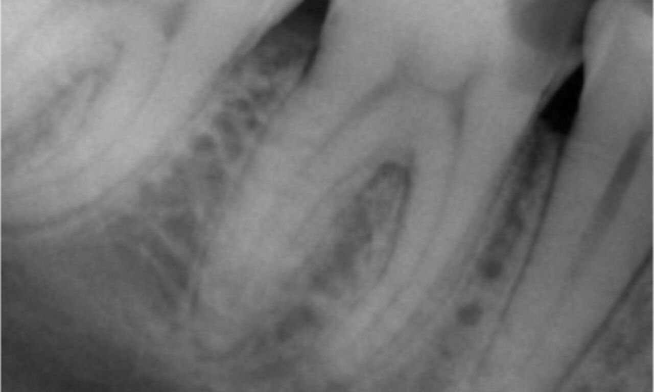 caso clínico de imagen radiológica TruNatomy de Abuelezz antes