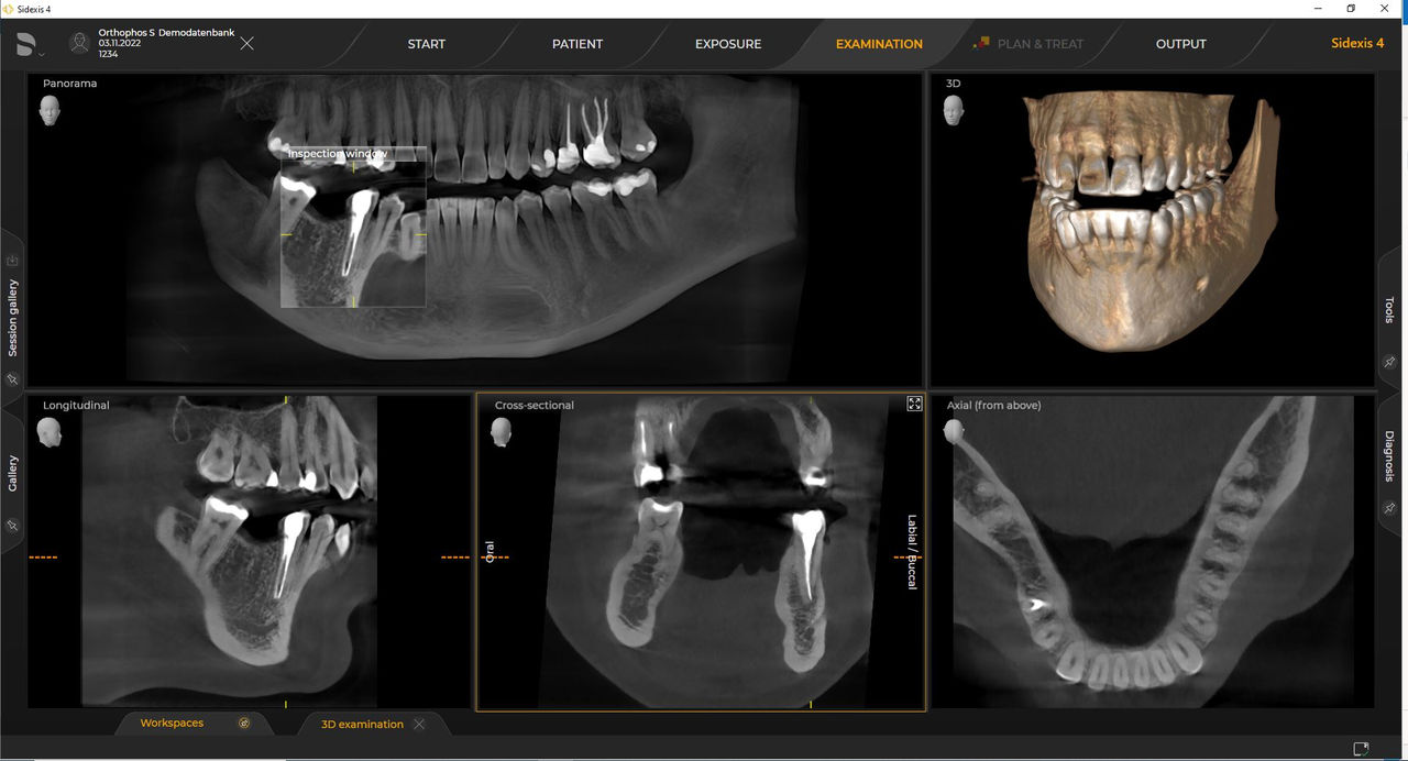 radiología 3d