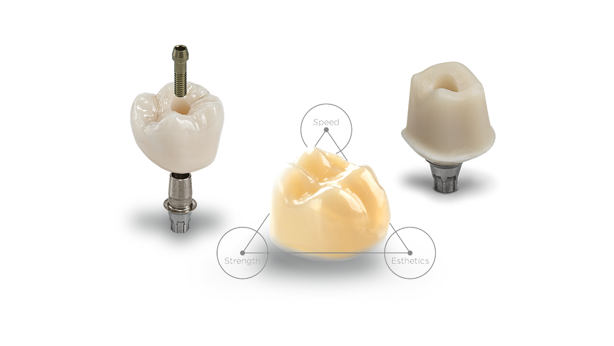 CEREC Tessera | Trifecta with Abutment Block