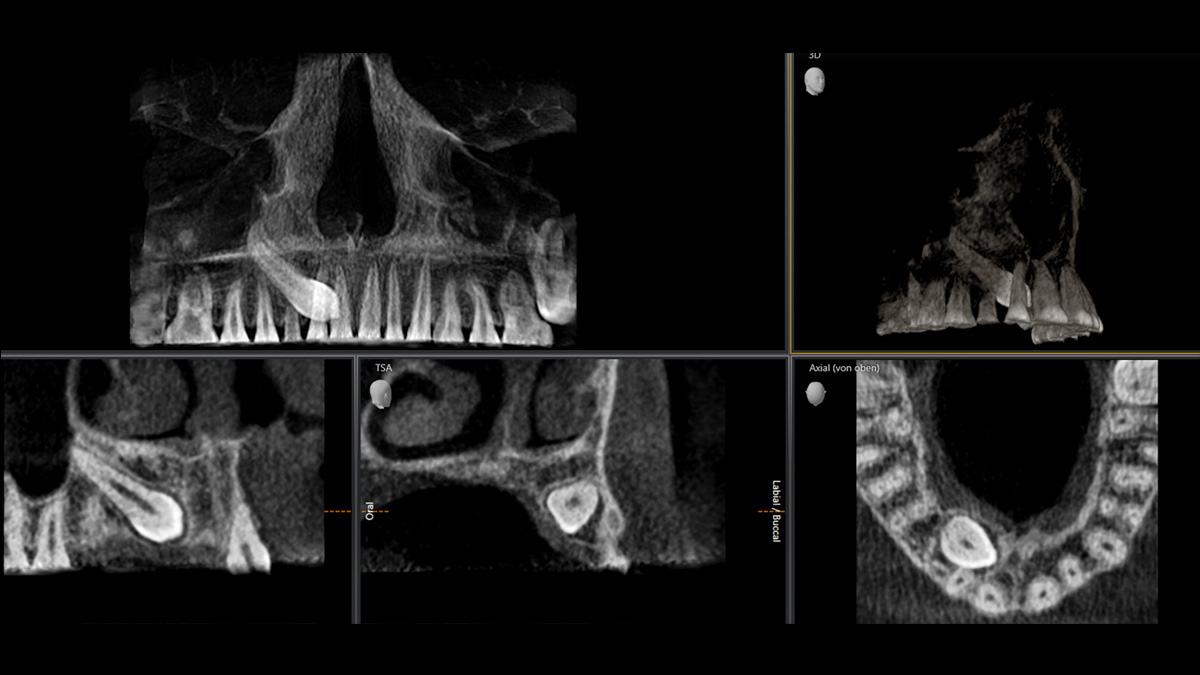 Radiografía dental