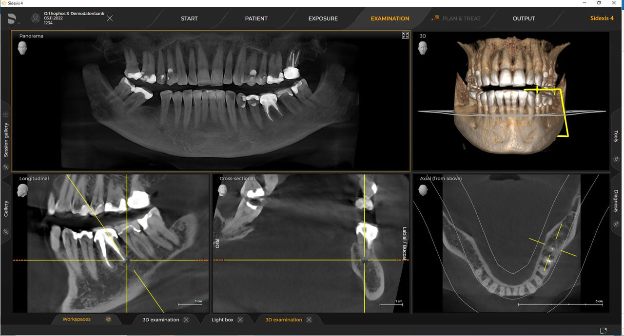 radiología 3d