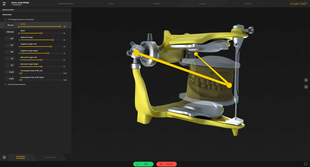 Articulador virtual  para visualizar rangos de movimiento completos y determinar superficies de contacto estáticas y dinámicas para una oclusión funcional adecuada.