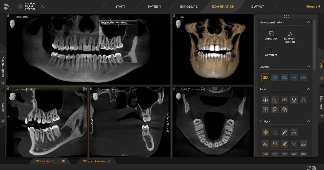 Imagen radiológica dental de un caso de implante