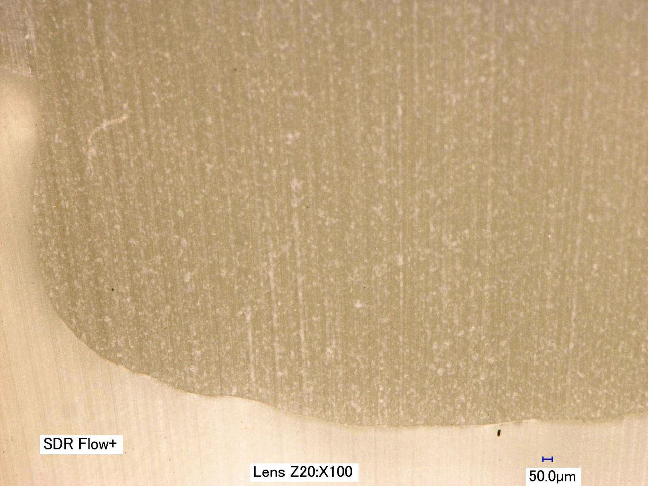 Class II | SDR flow+ showing no Margin Gap