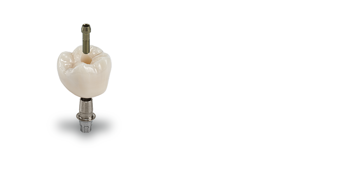 CEREC Tessera | Workflow | Abutment Crown