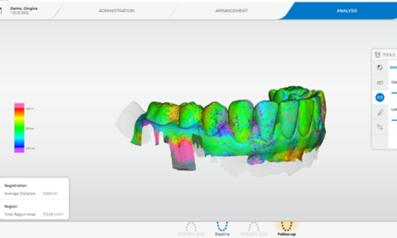 Distance Analysis with OraCheck 5