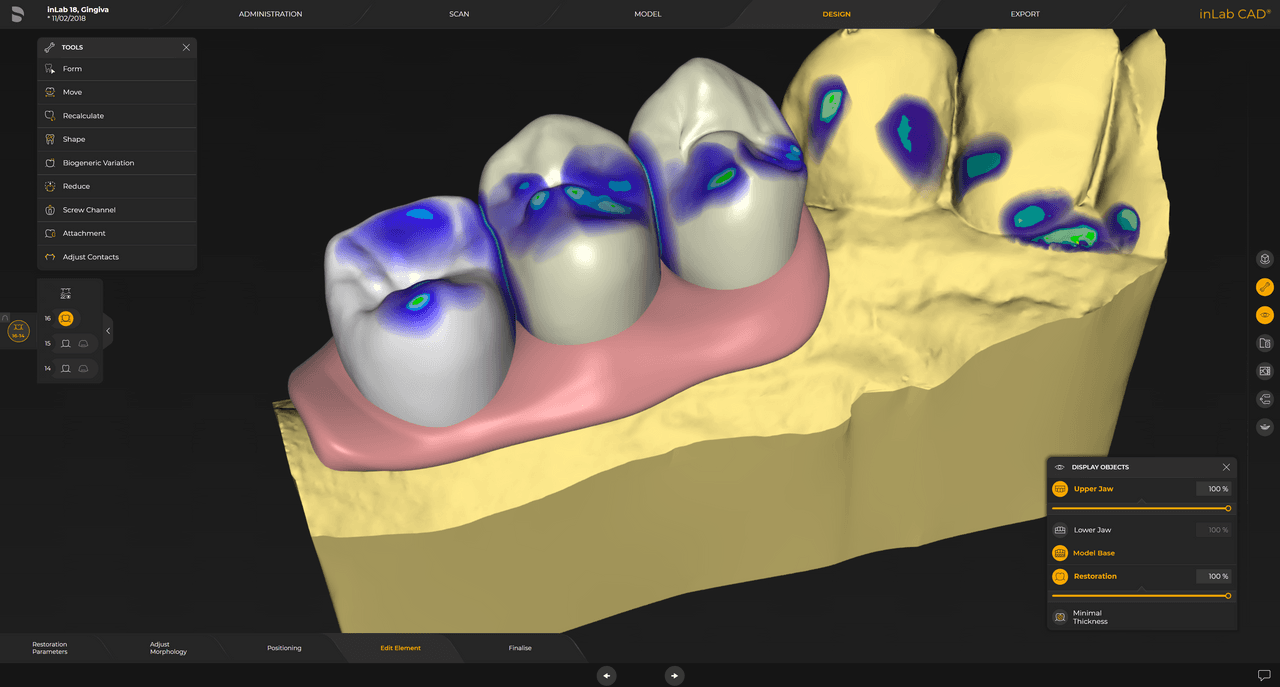 Diseño de elemento gingival para todos los tipos de restauración.