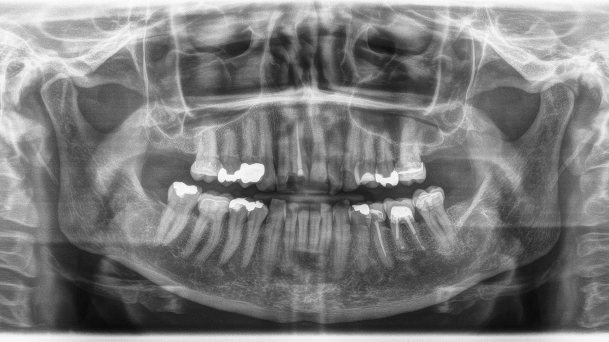 Radiografía extraoral 