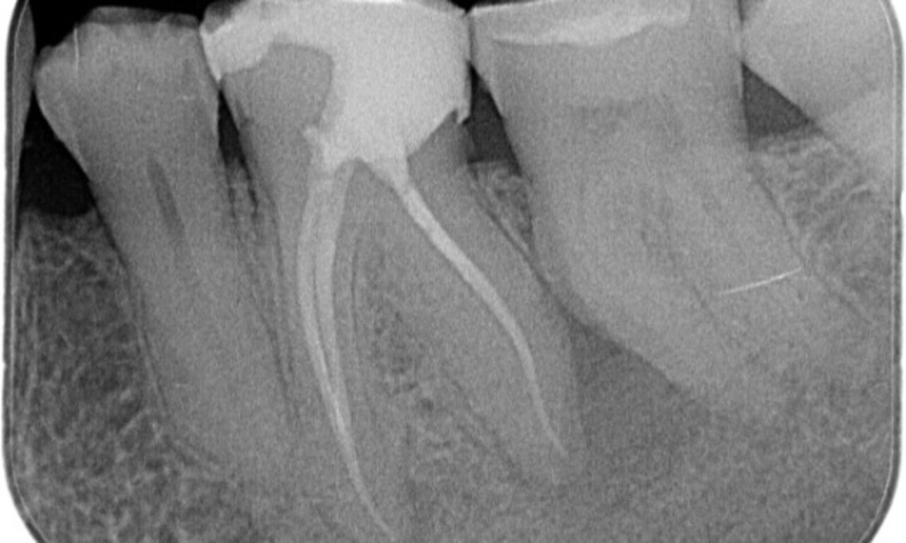 x ray clinical case TruNatom After