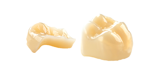 High Strength Glass Ceramcis | CEREC Tessera and Celtra Press restorations