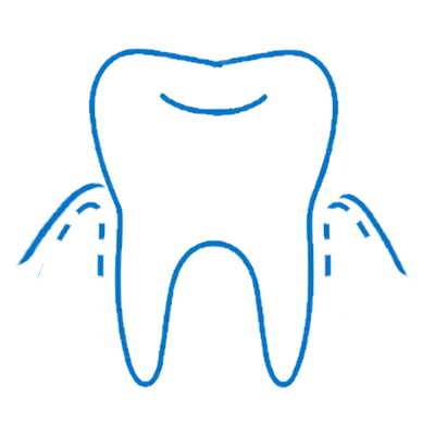 Icon blue gingivitis