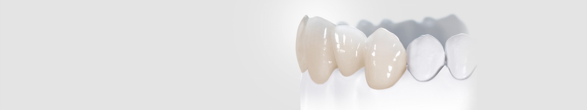 Vol Keramisch Kroon- En Brugwerk | Dentsply Sirona Benelux