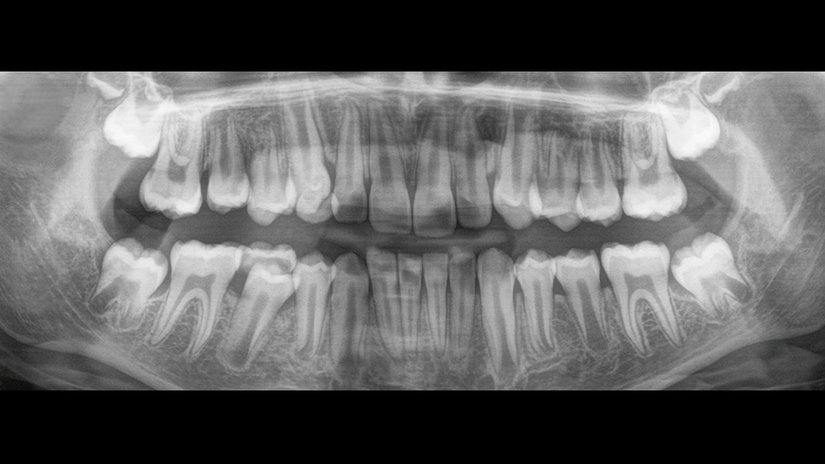 Tandheelkundige röntgenfoto van een kind