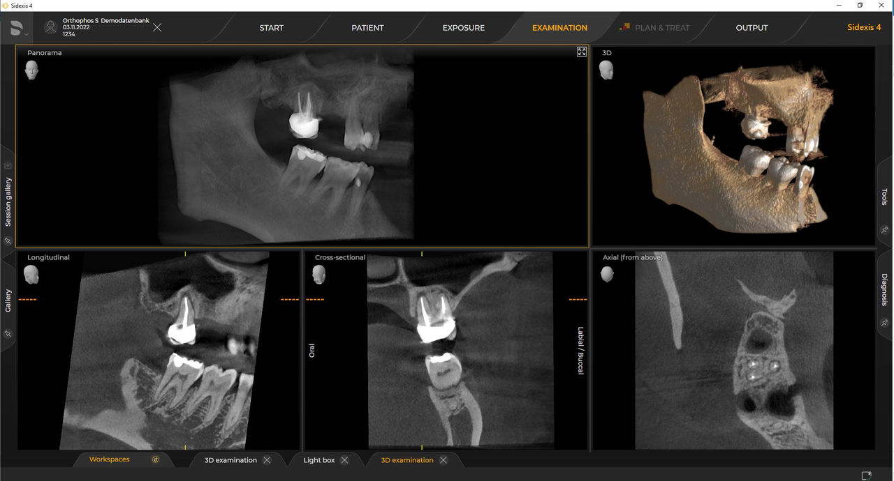 Radiografia dentária