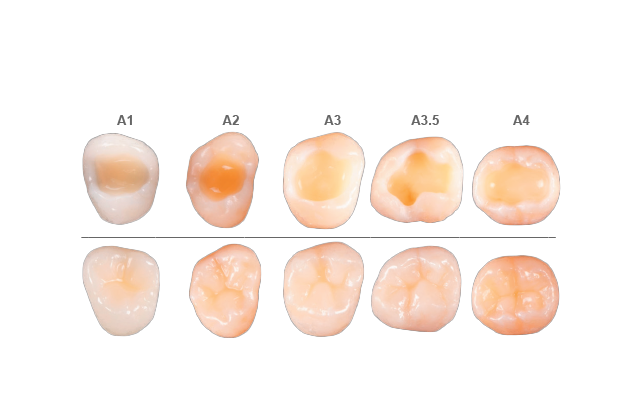 Class II | Easy Shade Match with A2 | Graphic without text