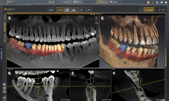 cbct viewer for mac